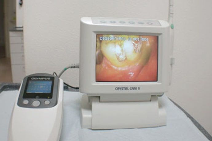 口腔内カメラと歯科用測色装置